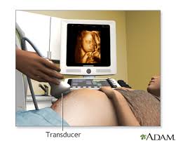 Ultrasound Obstetrics Simulation
